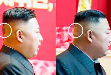 Con una mancha misteriosa y un vendaje en la parte posterior de su cabeza quedó registrado Kim Jong Un.