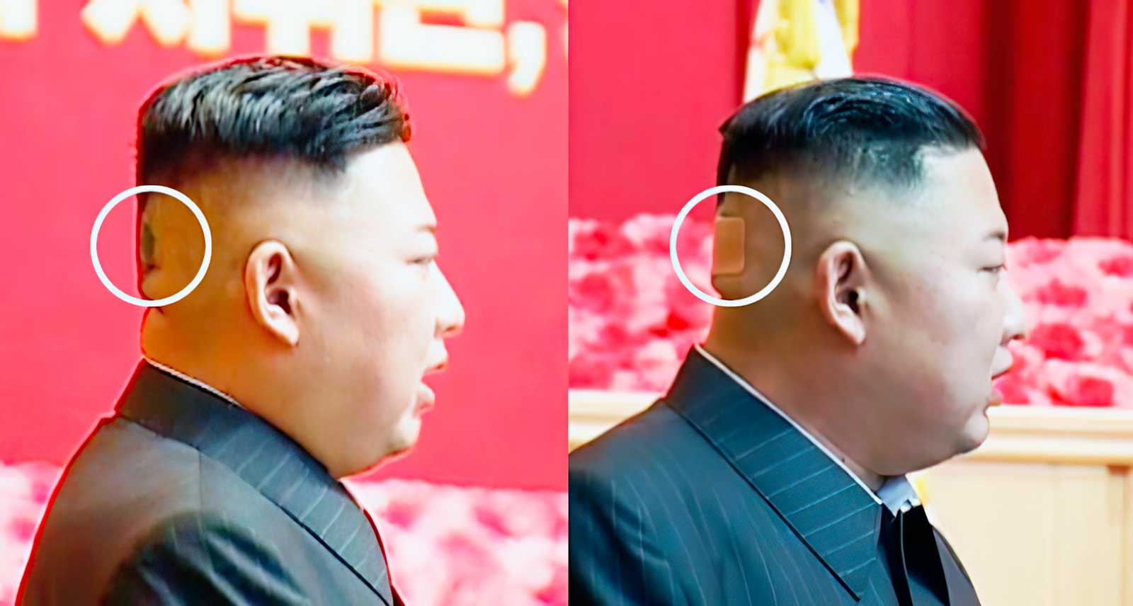 Con una mancha misteriosa y un vendaje en la parte posterior de su cabeza quedó registrado Kim Jong Un.