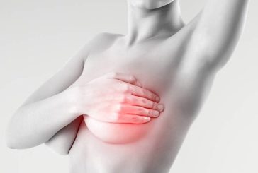 Siete síntomas principales para la detección del cáncer de mama