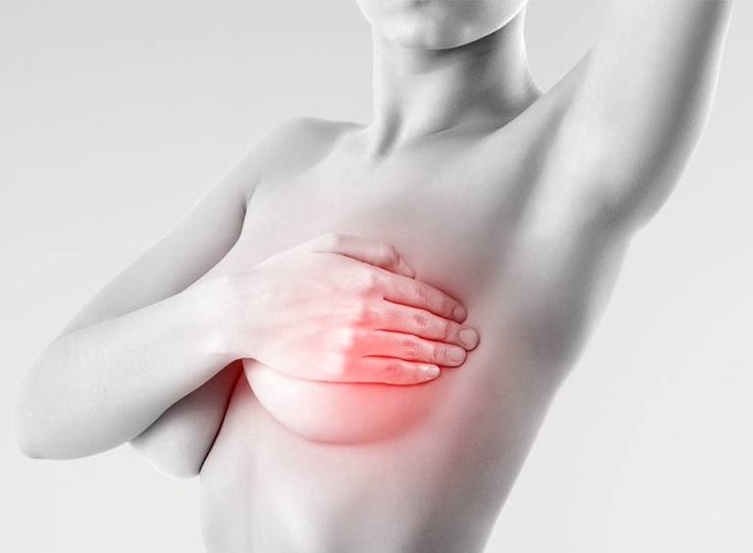 Siete síntomas principales para la detección del cáncer de mama
